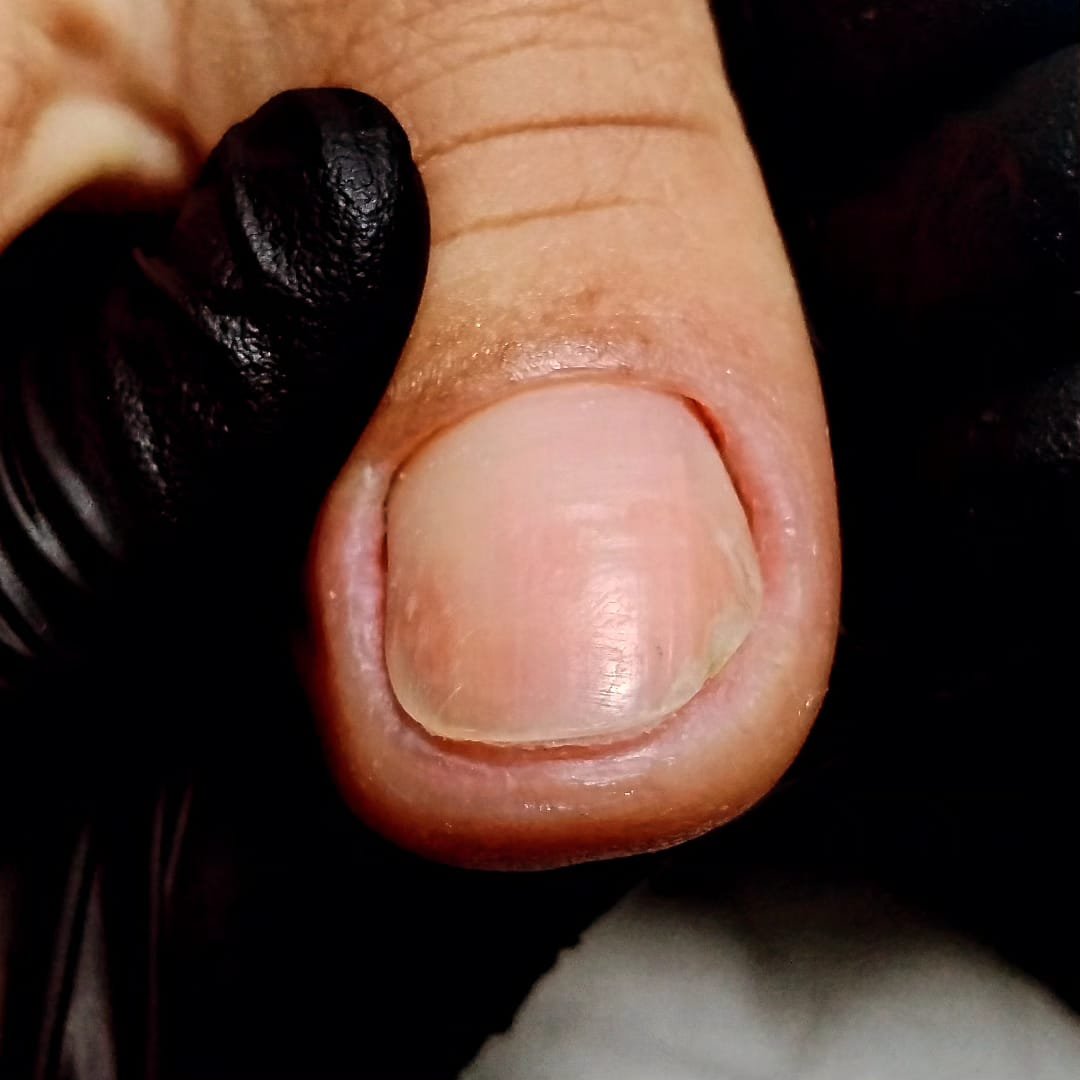Cuidado profissional em unhas