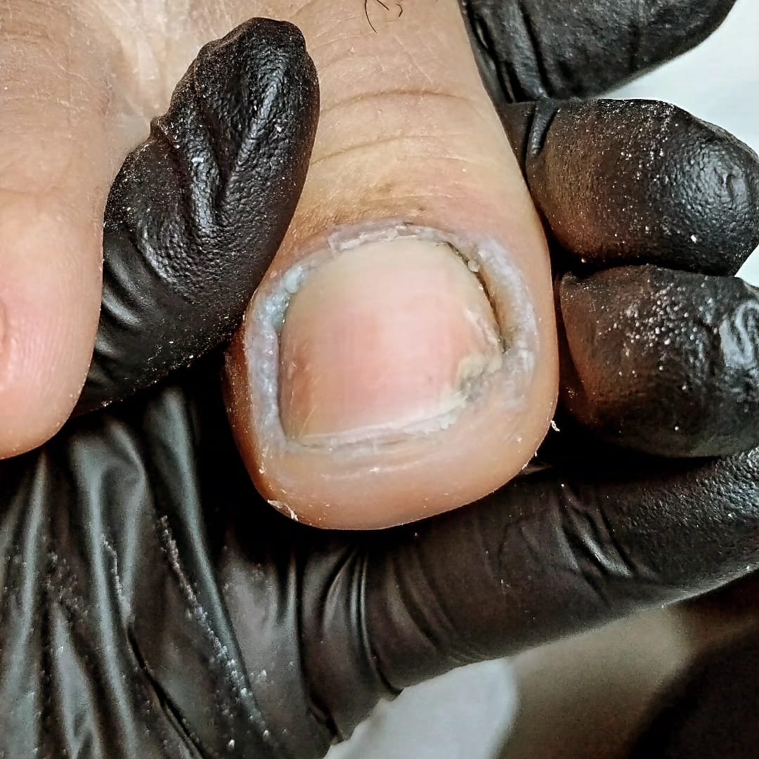 Detalhe de manicure em cliente